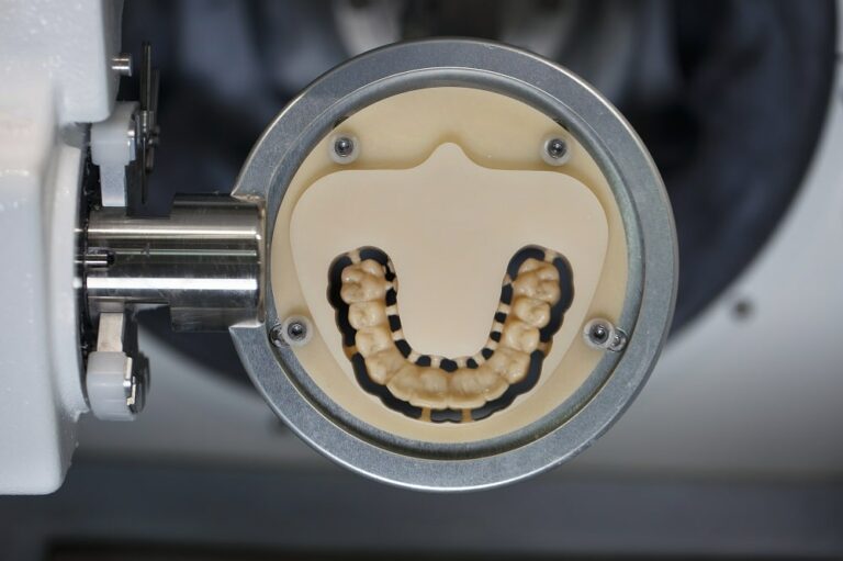 Made in France : ce que la fabrication française change concrètement pour vos prothèses dune dental